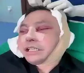 Penampakan Muka DPO Ujang Iskandar Pascaoperasi Plastik di Vietnam - Anak Buah Surya Paloh yang Ditangkap Kejagung!